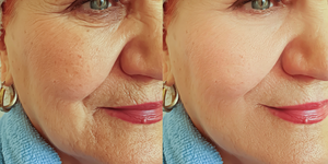 Old face dark spots